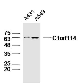 C1orf114 Rabbit Polyclonal Antibody