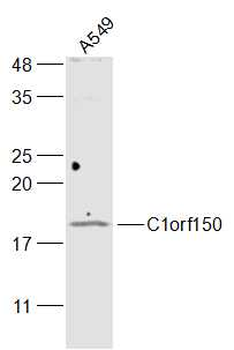 C1orf150 Rabbit Polyclonal Antibody