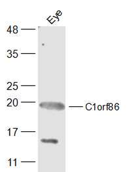 C1orf86 Rabbit Polyclonal Antibody