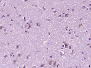C1QA Rabbit Polyclonal Antibody