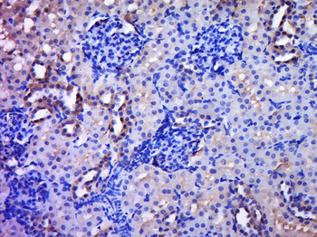 C20orf96 Rabbit Polyclonal Antibody