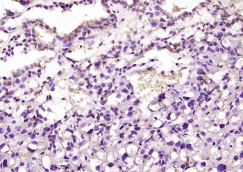 C2orf72 Rabbit Polyclonal Antibody