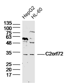 C2orf72 Rabbit Polyclonal Antibody