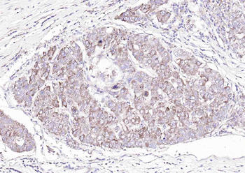 C6orf145 Rabbit Polyclonal Antibody