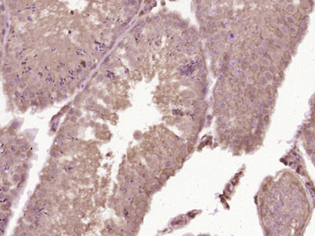 C6orf35 Rabbit Polyclonal Antibody