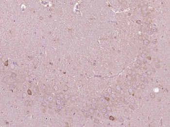 C6orf35 Rabbit Polyclonal Antibody