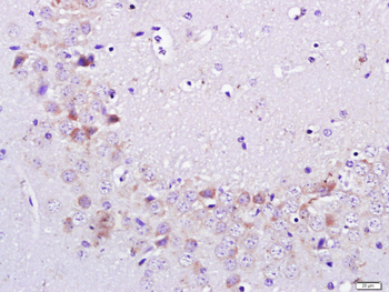C7orf16 Rabbit Polyclonal Antibody