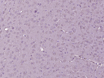 C7orf59 Rabbit Polyclonal Antibody