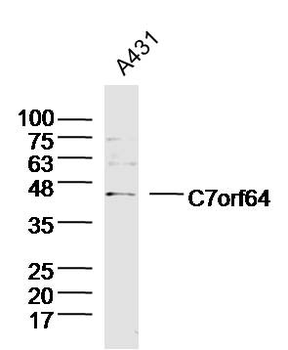 C7orf64 Rabbit Polyclonal Antibody