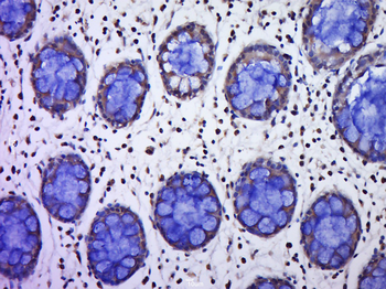C9orf96 Rabbit Polyclonal Antibody
