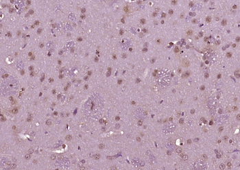 Phospho-c-ABL (Thr413) Rabbit Polyclonal Antibody