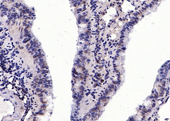 Calcipressin 3 Rabbit Polyclonal Antibody