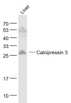 Calcipressin 3 Rabbit Polyclonal Antibody