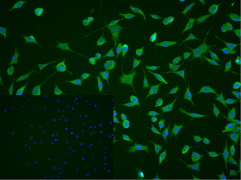 CaMK2 alpha Rabbit Polyclonal Antibody