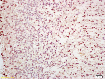 Capicua Rabbit Polyclonal Antibody