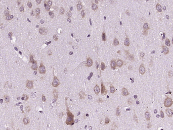 CAPRIN2 Rabbit Polyclonal Antibody