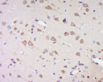 Phospho-CSNK1G 1+2+3 (Tyr263) Rabbit Polyclonal Antibody