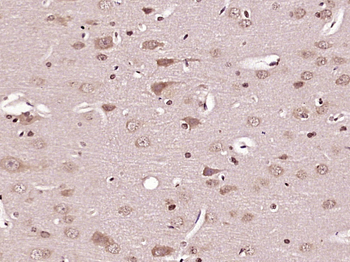 Caspase-6 subunit p11 Rabbit Polyclonal Antibody