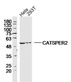 CATSPER2 Rabbit Polyclonal Antibody