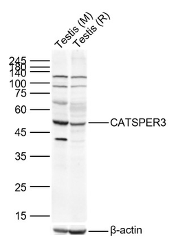 CATSPER3 Rabbit Polyclonal Antibody