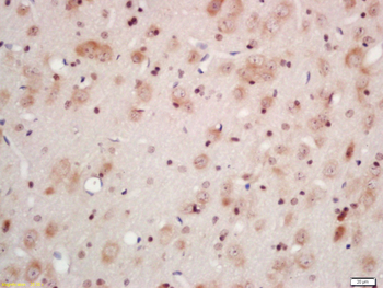 CCK8 Rabbit Polyclonal Antibody