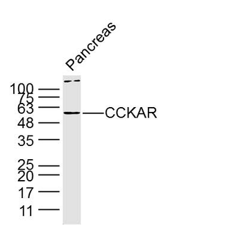 CCKAR Rabbit Polyclonal Antibody