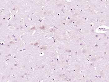 CD30 Rabbit Polyclonal Antibody
