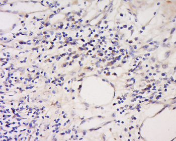Phospho-ITGB2 (Ser756) Rabbit Polyclonal Antibody