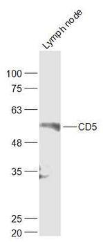 CD5 Rabbit Polyclonal Antibody