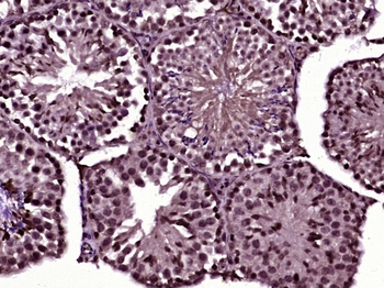 Cdc14A Rabbit Polyclonal Antibody