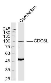 CDC5L Rabbit Polyclonal Antibody