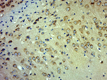 Phospho-c-Fos (Ser374) Rabbit Polyclonal Antibody
