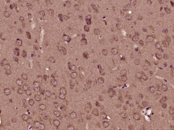 CHRNA9 Rabbit Polyclonal Antibody