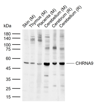 CHRNA9 Rabbit Polyclonal Antibody