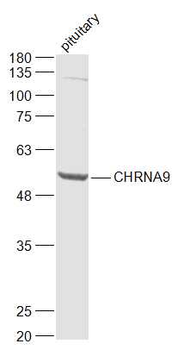 CHRNA9 Rabbit Polyclonal Antibody
