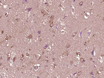 Phospho-c-Kit (Tyr730) Rabbit Polyclonal Antibody