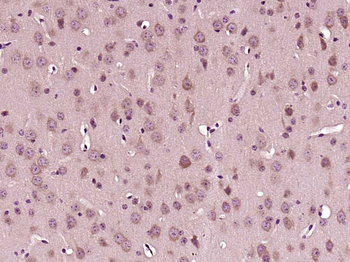 CLACP Rabbit Polyclonal Antibody