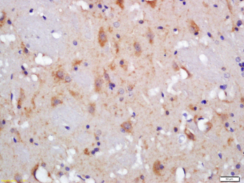 CLACP Rabbit Polyclonal Antibody