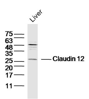 Claudin 12 Rabbit Polyclonal Antibody