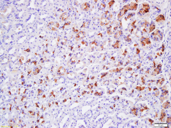 Claudin 19 Rabbit Polyclonal Antibody