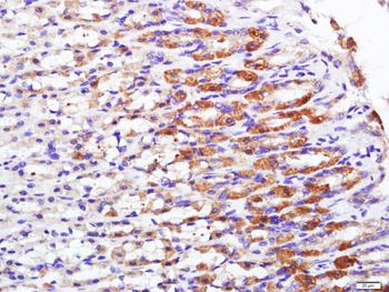 CLCA4 Rabbit Polyclonal Antibody