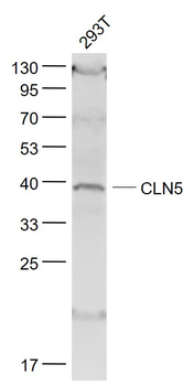 CLN5 Rabbit Polyclonal Antibody