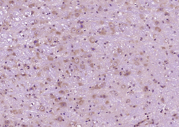CLSTN2 Rabbit Polyclonal Antibody