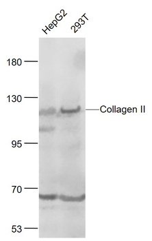 Collagen II Rabbit Polyclonal Antibody