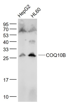 COQ10B Rabbit Polyclonal Antibody