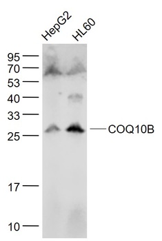 COQ10B antibody