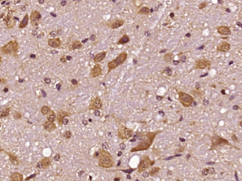 CPA3 Rabbit Polyclonal Antibody