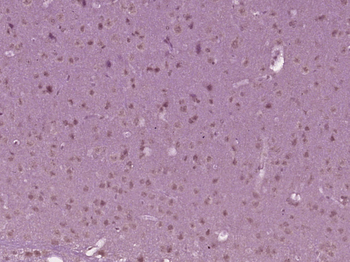 CRBN Rabbit Polyclonal Antibody