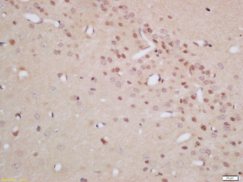 CRBN Rabbit Polyclonal Antibody