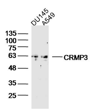 CRMP3 Rabbit Polyclonal Antibody